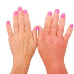 6 remedii casnice pentru a dezumfla mainile