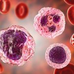 Monocite crescute in sange: simptome si tratamente