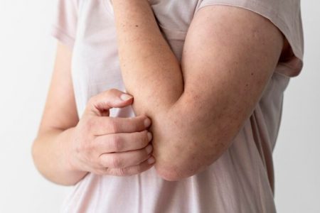 4 cauze comune pentru eczemă și cum să le evitați