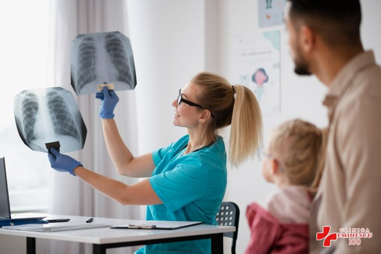 4 sfaturi de care să ții cont atunci c&acirc;nd te pregătești pentru o radiografie la plam&acirc;ni